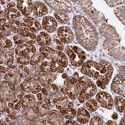 HSDL2 Antibody, Novus Biologicals 0.1mL; Unlabeled:Antibodies, Polyclonal