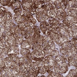 HSDL2 Antibody, Novus Biologicals 0.1mL; Unlabeled:Antibodies, Polyclonal