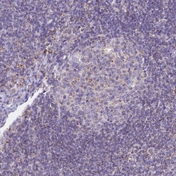 HSDL2 Antibody, Novus Biologicals 0.1mL; Unlabeled:Antibodies, Polyclonal