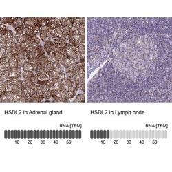 HSDL2 Antibody, Novus Biologicals 0.1mL; Unlabeled:Antibodies, Polyclonal