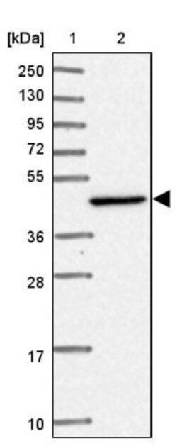 HSDL2 Antibody, Novus Biologicals:Antibodies:Primary Antibodies