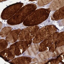 HSP20/HSPB6 Antibody, Novus Biologicals:Antibodies:Primary Antibodies