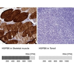 HSP20/HSPB6 Antibody, Novus Biologicals:Antibodies:Primary Antibodies