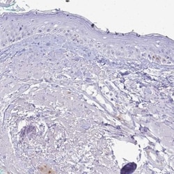 HSP20/HSPB6 Antibody, Novus Biologicals:Antibodies:Primary Antibodies