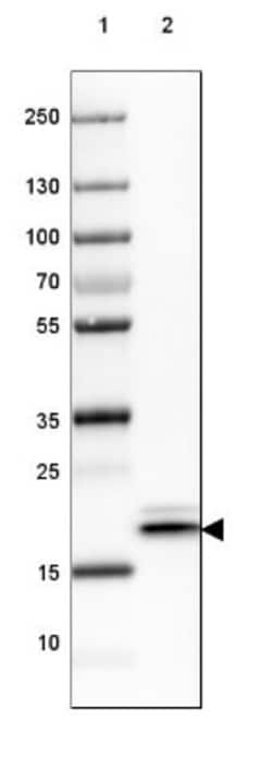 HSP20/HSPB6 Antibody, Novus Biologicals:Antibodies:Primary Antibodies