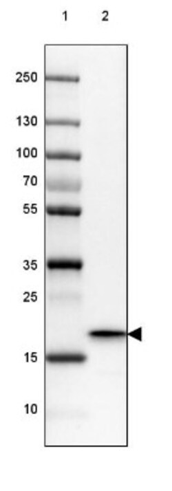 HSP20/HSPB6 Antibody, Novus Biologicals:Antibodies:Primary Antibodies