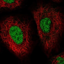 HSP40/DNAJB1 Antibody, Novus Biologicals 0.1mL; Unlabeled:Antibodies, Polyclonal