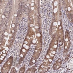 HSP40/DNAJB1 Antibody, Novus Biologicals 0.1mL; Unlabeled:Antibodies, Polyclonal