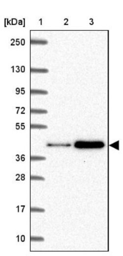 HSP40/DNAJB1 Antibody, Novus Biologicals 0.1mL; Unlabeled:Antibodies, Polyclonal