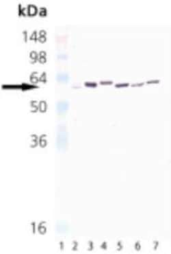 HSP65 (mycobacterial) Antibody (3F7), Novus Biologicals 0.2mL; Unlabeled:Antibodies,