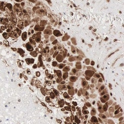 DDX1 Antibody, Novus Biologicals:Antibodies:Primary Antibodies