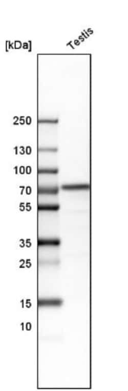 DDX1 Antibody, Novus Biologicals:Antibodies:Primary Antibodies