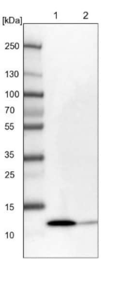 HSPC280 Antibody, Novus Biologicals 0.1mL; Unlabeled:Antibodies, Polyclonal