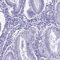 HSPC323 Antibody, Novus Biologicals 0.1mL; Unlabeled:Antibodies, Polyclonal