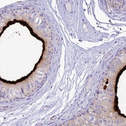 HSPC323 Antibody, Novus Biologicals 0.1mL; Unlabeled:Antibodies, Polyclonal