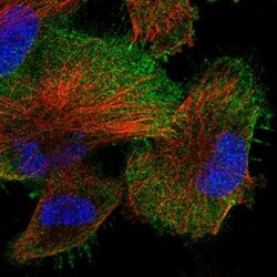 HTRA1/PRSS11 Antibody, Novus Biologicals 25 &mu;L; Unlabeled:Antibodies,