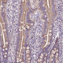 HTRA1/PRSS11 Antibody, Novus Biologicals 25 &mu;L; Unlabeled:Antibodies,