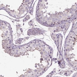 HTRA1/PRSS11 Antibody, Novus Biologicals 25 &mu;L; Unlabeled:Antibodies,