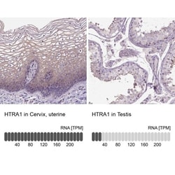 HTRA1/PRSS11 Antibody, Novus Biologicals 25 &mu;L; Unlabeled:Antibodies,