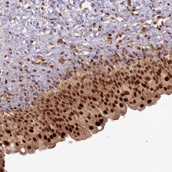 HUCE1 Antibody, Novus Biologicals 25 &mu;L; Unlabeled:Antibodies, Polyclonal