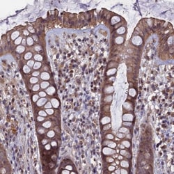 HUNK Antibody, Novus Biologicals 0.1mL; Unlabeled:Antibodies, Polyclonal