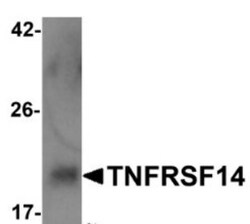 HVEM/TNFRSF14 Antibody - BSA Free, Novus Biologicals 0.1mg; Unlabeled:Antibodies,