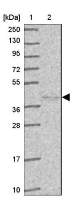 HYAL3 Antibody, Novus Biologicals 0.1mL; Unlabeled:Antibodies, Polyclonal