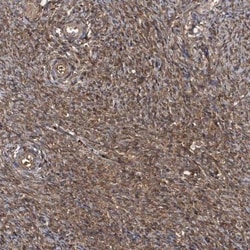 HYI Antibody, Novus Biologicals:Antibodies:Primary Antibodies