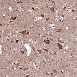 HYLS1 Antibody, Novus Biologicals 0.1mL; Unlabeled:Antibodies, Polyclonal