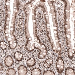 HYPB Antibody, Novus Biologicals 0.1mL; Unlabeled:Antibodies, Polyclonal