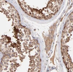 HYPM Antibody, Novus Biologicals:Antibodies:Primary Antibodies