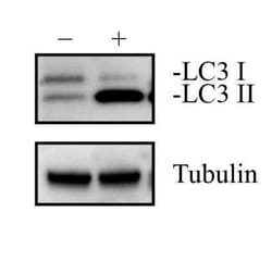 Novus Biologicals HeLa Chloroquine Treated/ Untreated Cell Lysate 2 Vials | Buy Online | Novus Biologicals&trade; | Fisher Scientific