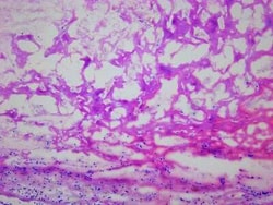 Novus Biologicals Heart Aorta Tissue Slides (Heart Disease)- Frozen 5 Slides | Buy Online | Novus Biologicals&trade; | Fisher Scientific