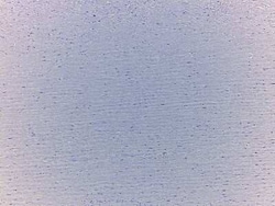 Novus Biologicals&trade;&nbsp;Heart Aorta Valve Tissue Slides (Adult Normal)- Paraffin
