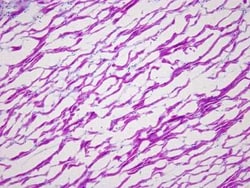 Novus Biologicals Heart Interventricular Septum Tissue Slides (Arrhythmia)- Frozen 5 Slides | Buy Online | Novus Biologicals&trade; | Fisher Scientific