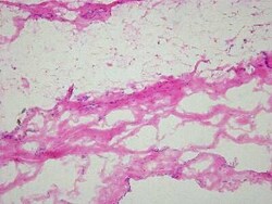 Novus Biologicals Heart Pericardium Tissue Slides (Lupus)- Frozen 5 Slides | Buy Online | Novus Biologicals&trade; | Fisher Scientific