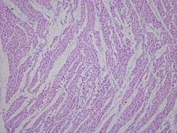 Novus Biologicals Heart Ventricle Tissue Slides (Arrhythmia Right)- Paraffin 5 Slides | Buy Online | Novus Biologicals&trade; | Fisher Scientific