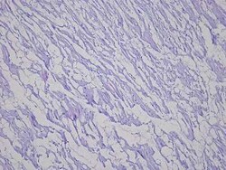 Novus Biologicals Heart Ventricle Tissue Slides (Hypertension Right)- Paraffin 5 Slides | Buy Online | Novus Biologicals&trade; | Fisher Scientific