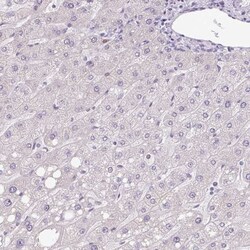 Hemicentin 2 Antibody, Novus Biologicals:Antibodies:Primary Antibodies