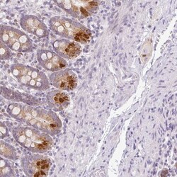 Hemicentin 2 Antibody, Novus Biologicals:Antibodies:Primary Antibodies