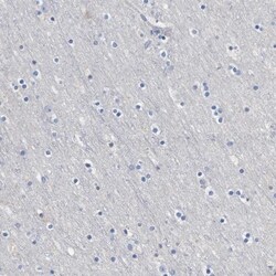 Hemogen Antibody, Novus Biologicals:Antibodies:Primary Antibodies