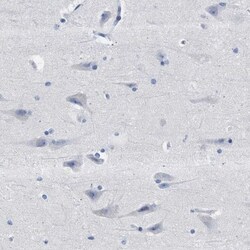 Hemogen Antibody, Novus Biologicals:Antibodies:Primary Antibodies
