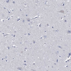 Hemogen Antibody, Novus Biologicals:Antibodies:Primary Antibodies