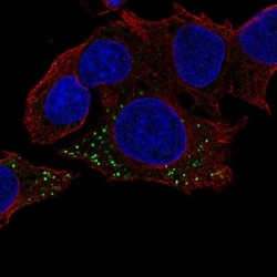 Hemoglobin beta Antibody, Novus Biologicals:Antikörper:Primärantikörper