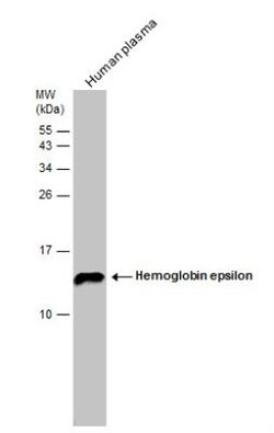 Hemoglobin epsilon Antibody, Novus Biologicals 0.1mL:Antibodies, Polyclonal