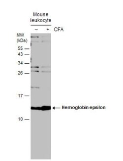 Hemoglobin epsilon Antibody, Novus Biologicals 0.1mL:Antibodies, Polyclonal