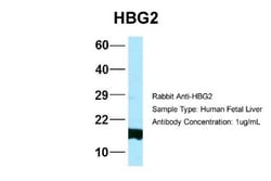 HBG1/2 Antibody, Novus Biologicals 0.05mg; Unlabeled:Antibodies, Polyclonal