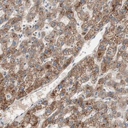 Hepsin Antibody, Novus Biologicals 25 &mu;L; Unlabeled:Antibodies, Polyclonal