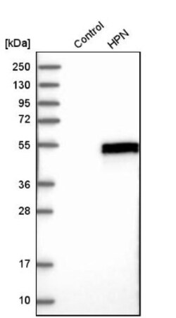 Hepsin Antibody, Novus Biologicals 25 &mu;L; Unlabeled:Antibodies, Polyclonal