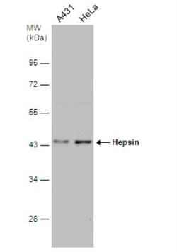 Hepsin Antibody, Novus Biologicals 0.1mL; Unlabeled:Antibodies, Polyclonal
